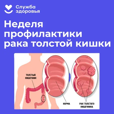 Сыктывкар | С 7 по 13 ноября 2022г — неделя профилактики рака толстой кишки  - БезФормата