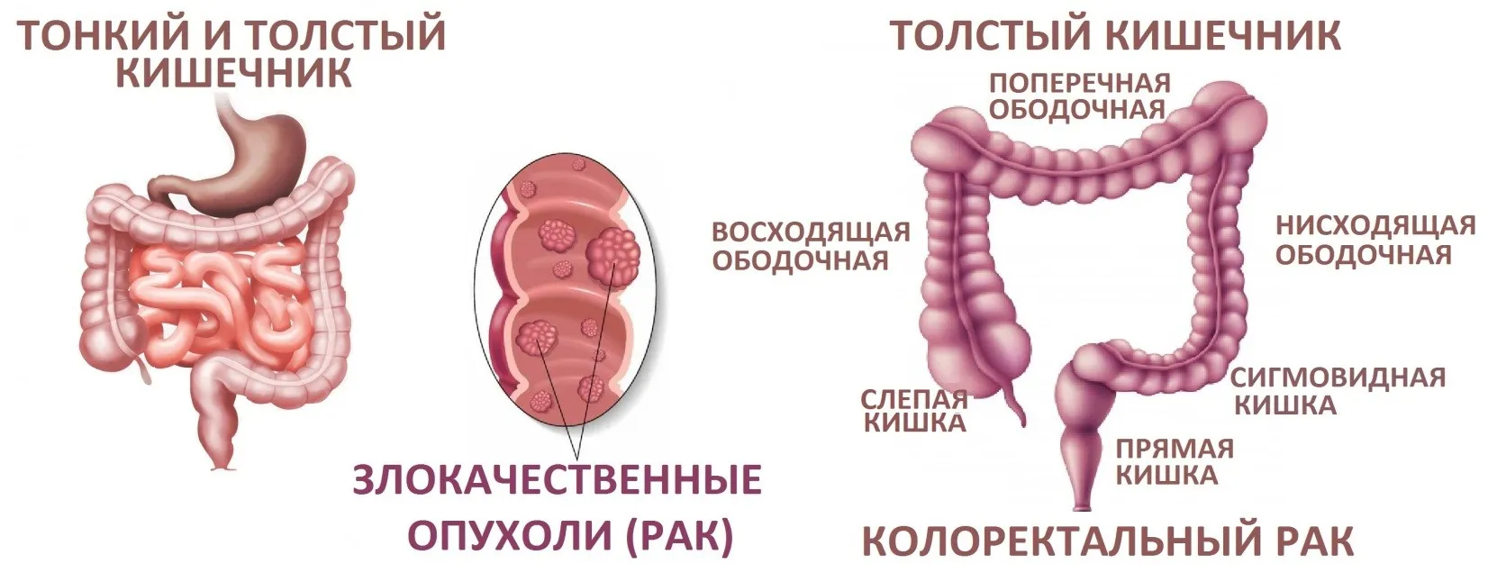 толстый кишечник строение картинки