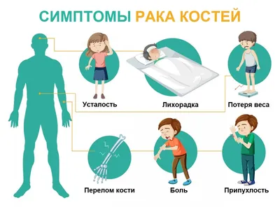 Рак костей: первые симптомы, фото, лечение, стадии и прогноз жизни