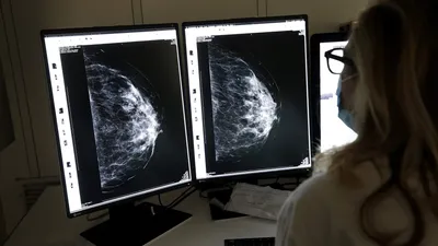 Захочешь — будешь жить»: истории женщин, которые перенесли рак груди |  Статьи | Известия