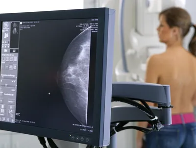 Как выглядит рак молочной железы на снимке маммографии, может ли определить  и что показывает маммография при раке