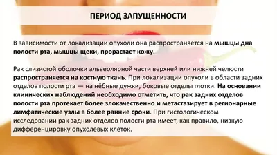 Рак полости рта: диагностика и лечение в Одессе | Медицинский дом Odrex