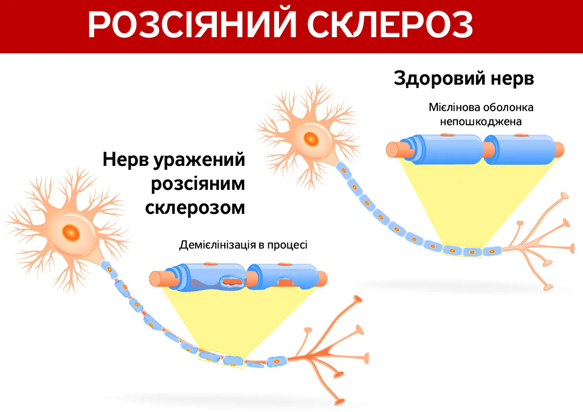 День рассеянного склероза картинки прикольные