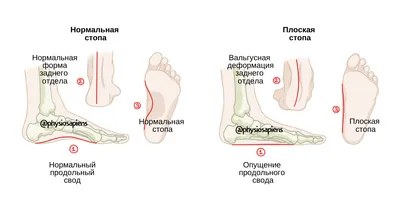 Техника самомассажа голени - Журнал - Weleda