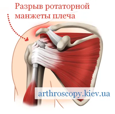 Болит плечо: причины, лечение боли в плечевом суставе