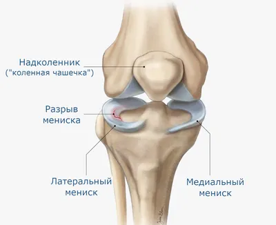 5 бодибилдеров, у которых лопались мышцы - YouTube