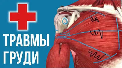 Разрыв мениска: причины, симптомы и лечение в Москве в клинике «Ваш Доктор»