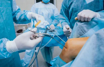 Артроскопия коленного сустава операция в СПб - сделать артроскопию колена,  цены
