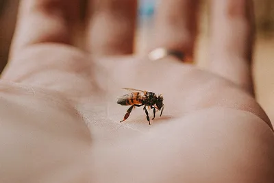 Что делать, если укусила пчела: ТОП-5 советов для первой помощи