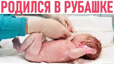 Родился в рубашке\"- так обычно говорят, о везунчиках, которые чудом  избегают неприятностей. Но вообще - то, родиться в рубашке можно не… |  Instagram