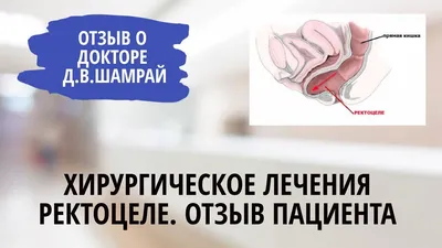 Хирургическое лечения ректоцеле. Отзыв - YouTube