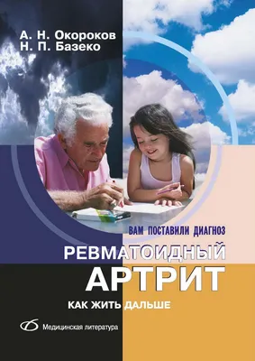 Купить Ревматоидный артрит. Как жить дальше, цена 350 грн — Prom.ua  (ID#1400318441)