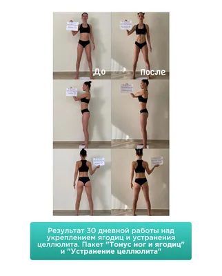 Результаты похудения, до и после, …» — создано в Шедевруме