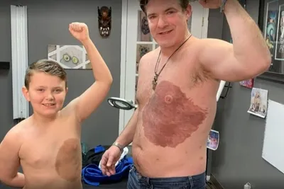 Отец 30 часов набивал татуировку родимого пятна, чтобы поддержать cына -  видео
