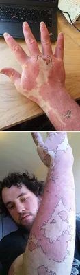 Татуировки, скрывающие родимые пятна ☆ Лучшие фото!
