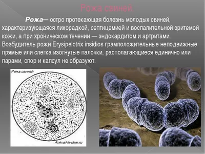 Рожа: причины, симптомы и лечение в статье инфекциониста Николаенко А. А.