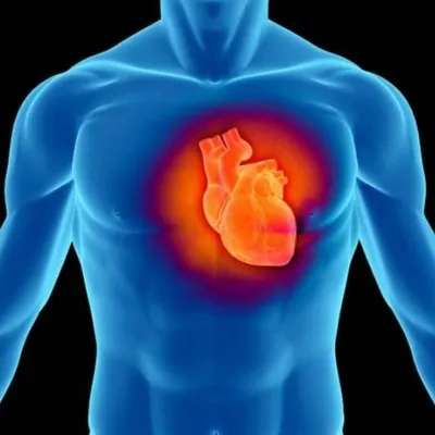 Инфаркт: профилактика и симптомы - ЗНАЙ ЮА