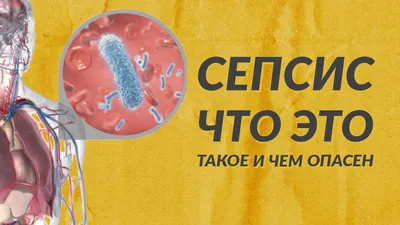 Что такое сепсис и почему он опасен? | Dr. Kichinsky. О здоровье и медицине  | Дзен