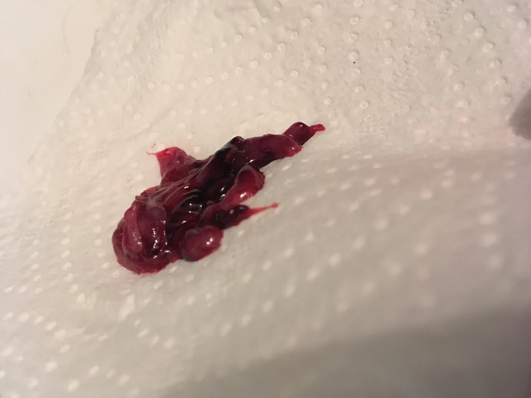 сгустки крови в сперме мужчин фото 41
