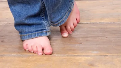Шипица на ноге у ребенка, причины лечение ступни как вывести диагностика  медикаменты нетрадиционные малоинвазивные методы хирургическое удаление