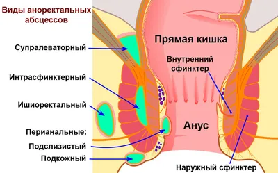 Шишка возле заднего прохода фотографии