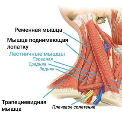 Синдром лестничной мышцы | Алиса Жукова | Дзен