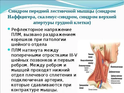 Последствия грыжи шейного отдела позвоночника: осложнения