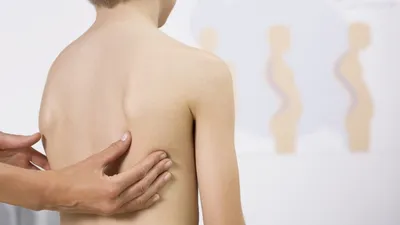 Сколиоз - лечение остеопатией позвоночника у детей