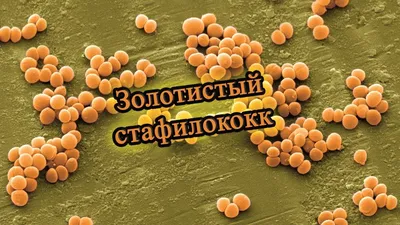 Золотистый стафилококк. Микробиолоия | Staphylococcus aureus - YouTube