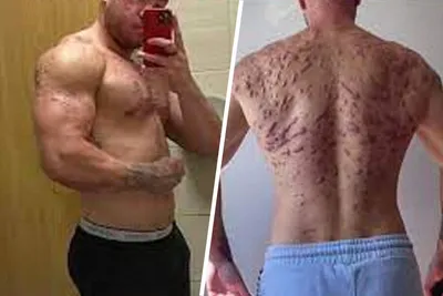 Бодибилдер показал, как стероиды изуродовали его тело - Газета.Ru | Новости