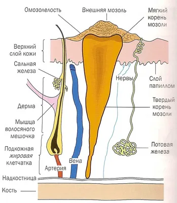 Удаление мозолей (простое, криодеструкция, лазером, электрокоагуляция,  аппаратом \