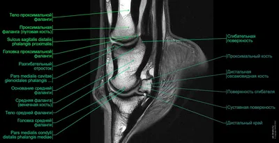 Анатомия Лошади — стоковые фотографии и другие картинки Лошадь - Лошадь,  Costal Surface, Анатомическая модель - iStock