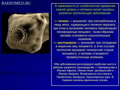 Свиной Цепень Taenia Solium — стоковая векторная графика и другие  изображения на тему Ленточный червь - Ленточный червь, Антиквариат, Белый  фон - iStock