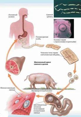 Презентация по ОП. 04 Медицинская паразитология на тему \"Свиной цепень\"