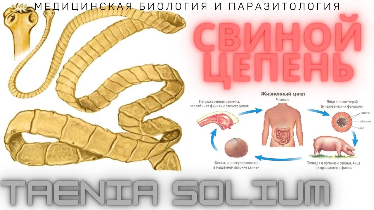 Свиной цепень диагностика. Профилактика свиного цепня. Taenia solium жизненный цикл. Taeniarhynchus saginatus жизненный цикл.