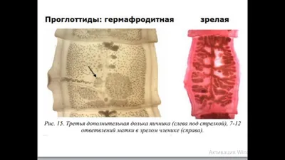 Топ самых опасных пищевых паразитов – тема научной статьи по клинической  медицине читайте бесплатно текст научно-исследовательской работы в  электронной библиотеке КиберЛенинка