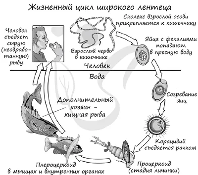 Вы можете ничего не знать о червяке»: как красноярцам удаляют органы из-за  паразитов и можно ли выявить «чужого» в организме