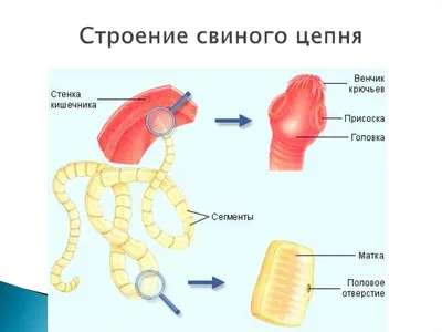 СВИНОЙ ЦЕПЕНЬ – вооружен и опасен | Книга Человека | Дзен