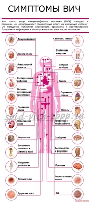 ᐉ Симптомы ВИЧ, СПИДа у женщин на ранних и поздних стадиях c фото и видео ◉