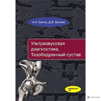 Ультразвуковая диагностика. Тазобедренный сустав (9226), купить в  интернет-магазине: цена, отзывы – Лавка Бабуин, Киев, Украина