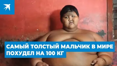 Самый толстый мальчик в мире похудел на 100 кг - YouTube