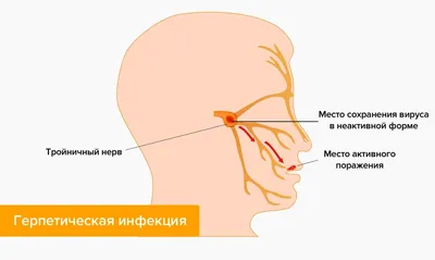 Заболевания тройничного нерва — симптомы, причины, последствия — Startsmile