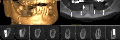 Консервативное лечение невралгии тройничного нерва в Херсоне | Neuro.ks.ua.