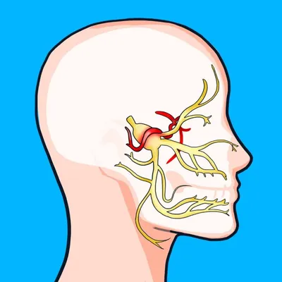 ЗАБОЛЕВАНИЯ ТРОЙНИЧНОГО И ЛИЦЕВОГО НЕРВОВ