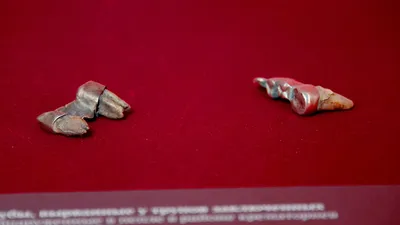 Экспонат ВОВ ✩ Зал 23: Зубы, вырванные у трупов заключенных, обнаруженные в  пепле в районе крематориев лагеря Освенцим | «Дорога Памяти»