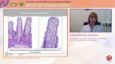 Сабельникова Е.А. Целиакия как правильно поставить диагноз - YouTube