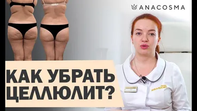 Как избавиться от целлюлита ▶️ 4 стадии и все методики борьбы