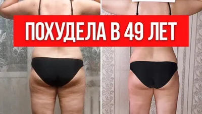 3 простых способа, как убрать ЖИРОВОЙ ЦЕЛЛЮЛИТ на ногах и ягодицах за месяц  - YouTube