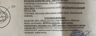 Радиоволновое лечение дисплазии шейки матки - «Безболезненная и необходимая  операция для женщин с патологиями шейки» | отзывы