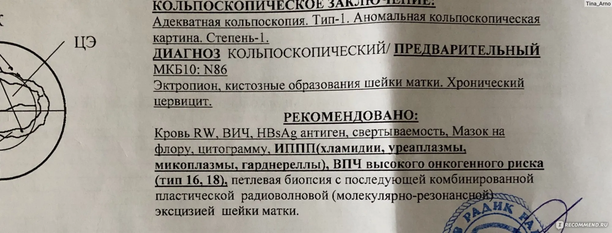 Результат кольпоскопии шейки матки. Диагнозы по кольпоскопии. Кольпоскопия диагноз. Кольпоскопия заключение. Протокол кольпоскопии.